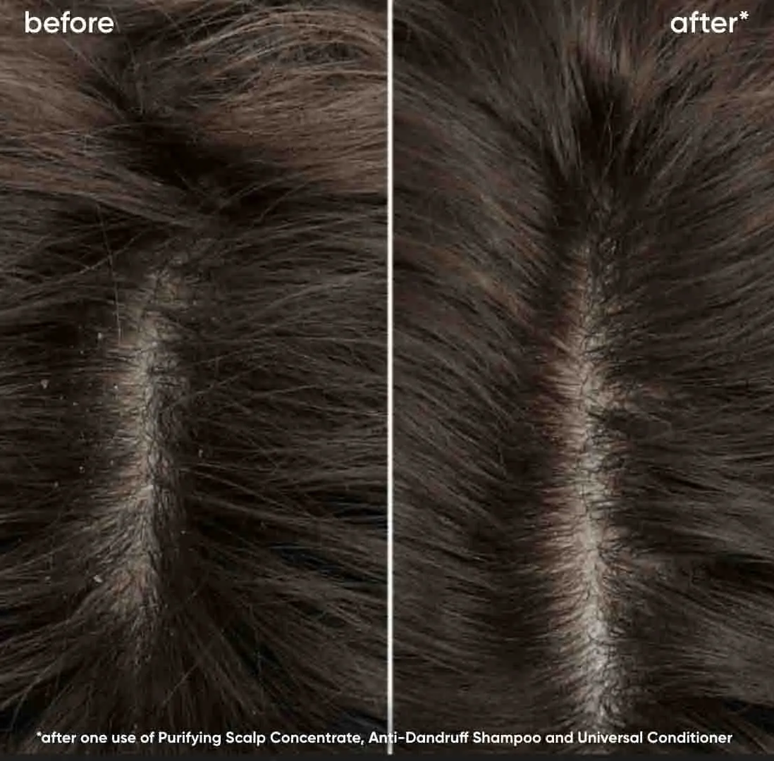 Biolage Scalp Sync Anti-Dandruff Shampoo 400ml