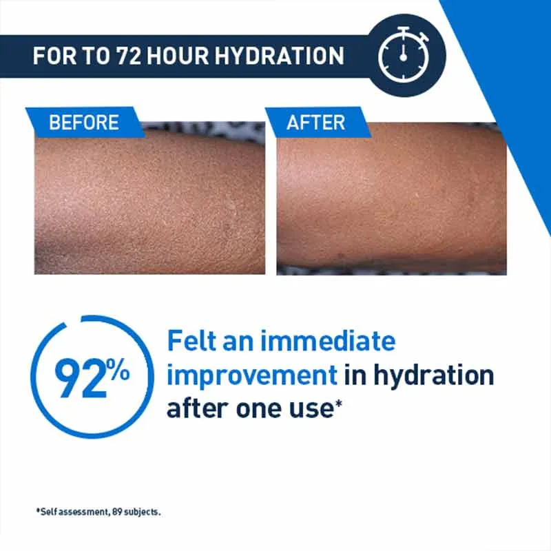 CeraVe Intensive Moisturising Lotion For Very Dry, Itchy Skin