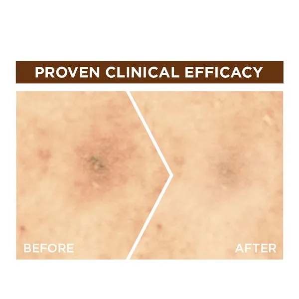 Fast Bright 10% Pure Vitamin C Brightening Overnight Serum - 30ml