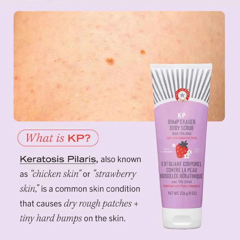 First Aid Beauty KP Bump Eraser Body Scrub Fresh Strawberry