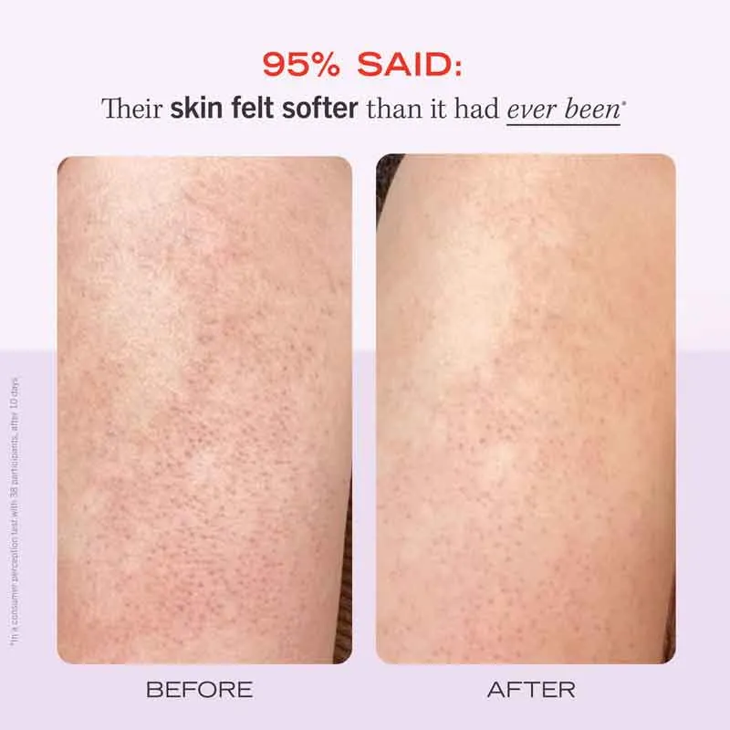 First Aid Beauty KP Bump Eraser Body Scrub Fresh Strawberry