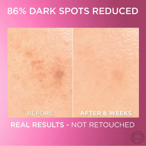 Glycolic Bright Serum with 8% [Melasyl ?   Glycolic Acid   Niacinamide] face serum for Dark Spots & Brightening 30ml