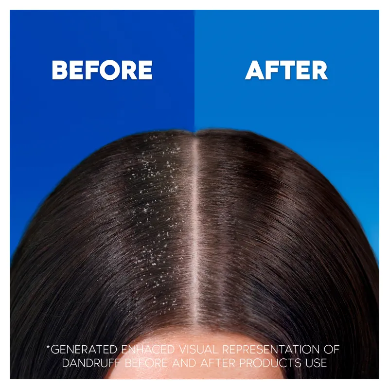 Head & Shoulders Classic Clean 2 In 1 Shampoo 590ML