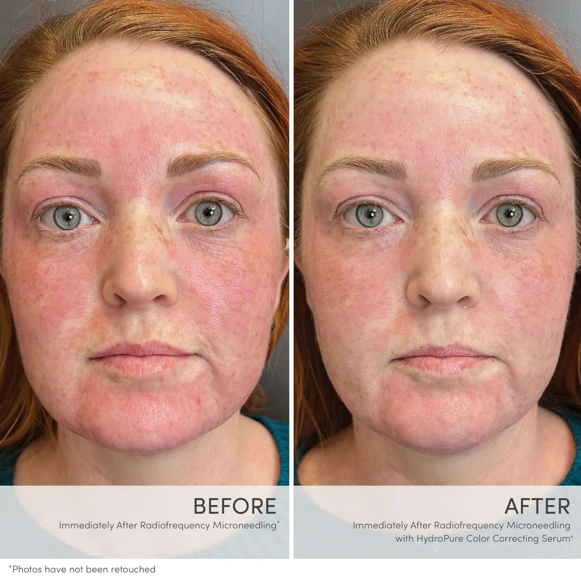 Jane Iredale HydroPurea??Color Correcting Serum with Hyaluronic Acid & CoQ10