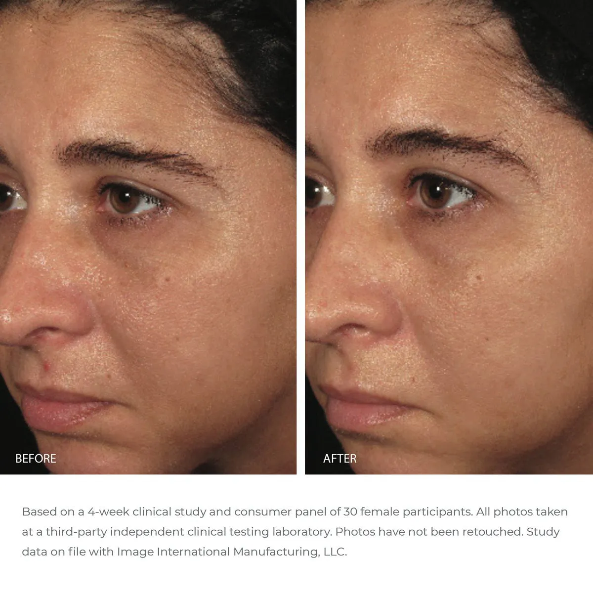 ORMEDIC balancing biopeptide crme | IMAGE Skincare