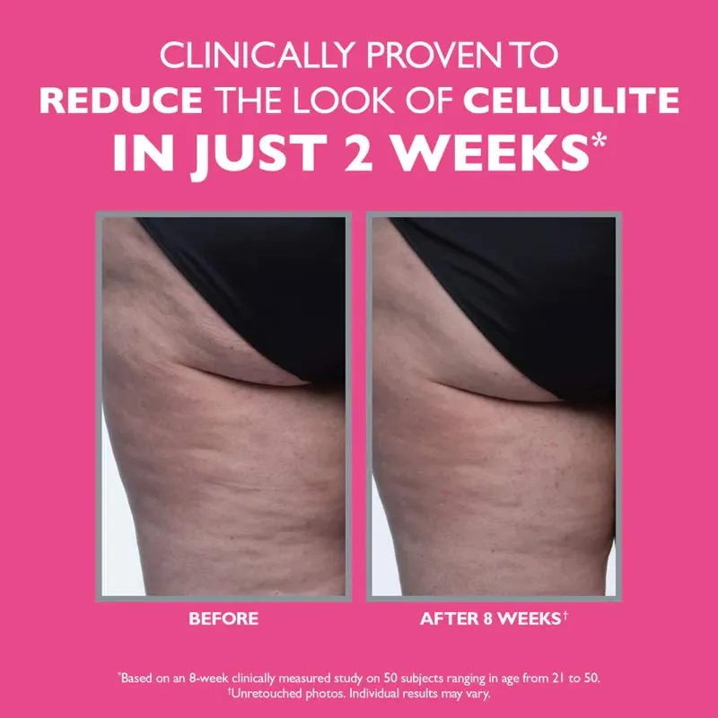 Peter Thomas Roth FIRMx Tight & Toned Cellulite Treatment