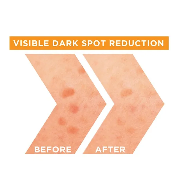 Skin Active Fast Bright Vitamin C   Niacinamide 30x Brightening Booster Day Serum