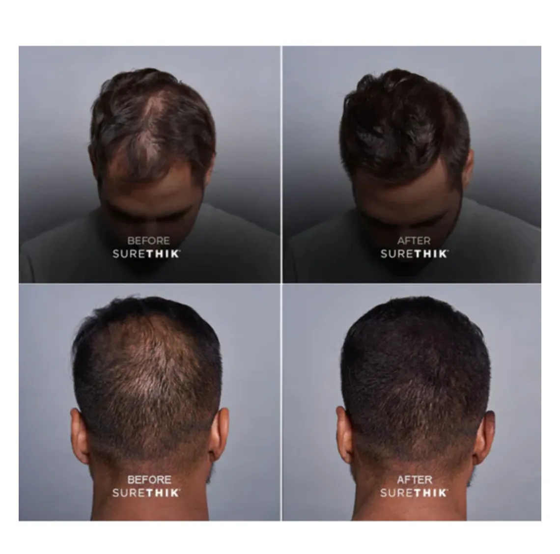 SureThik Hair Thickening Fibers Dark Brown