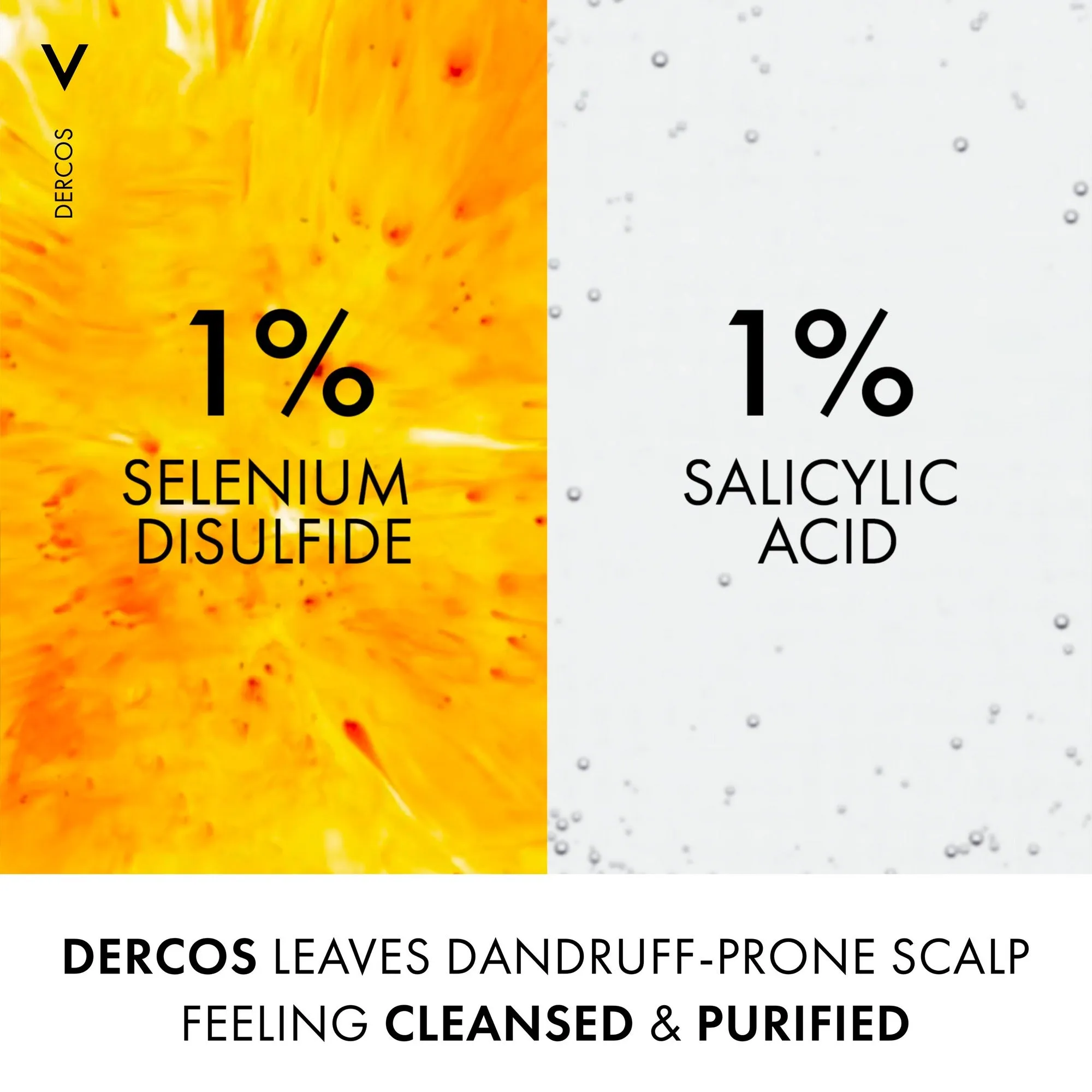 Vichy Dercos Anti-Dandruff - Normal to Oily Hair Shampoo 200ml